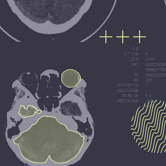 Annotating CT scans for Digital Radiology and Medical AI application