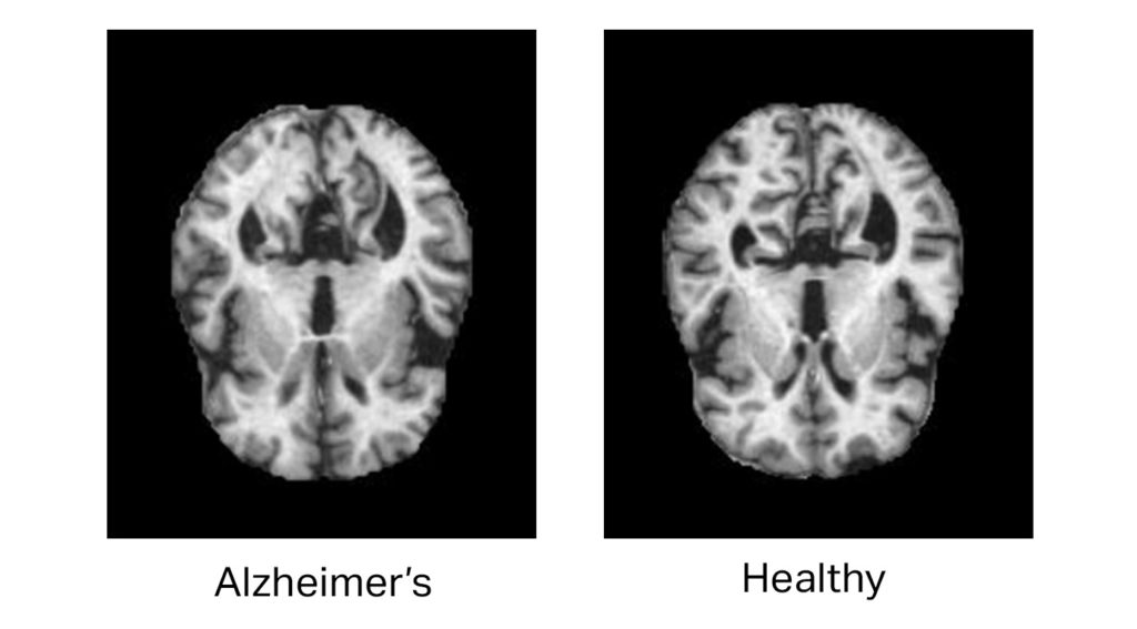 Why Healthcare Data is a Minefield for AI Research