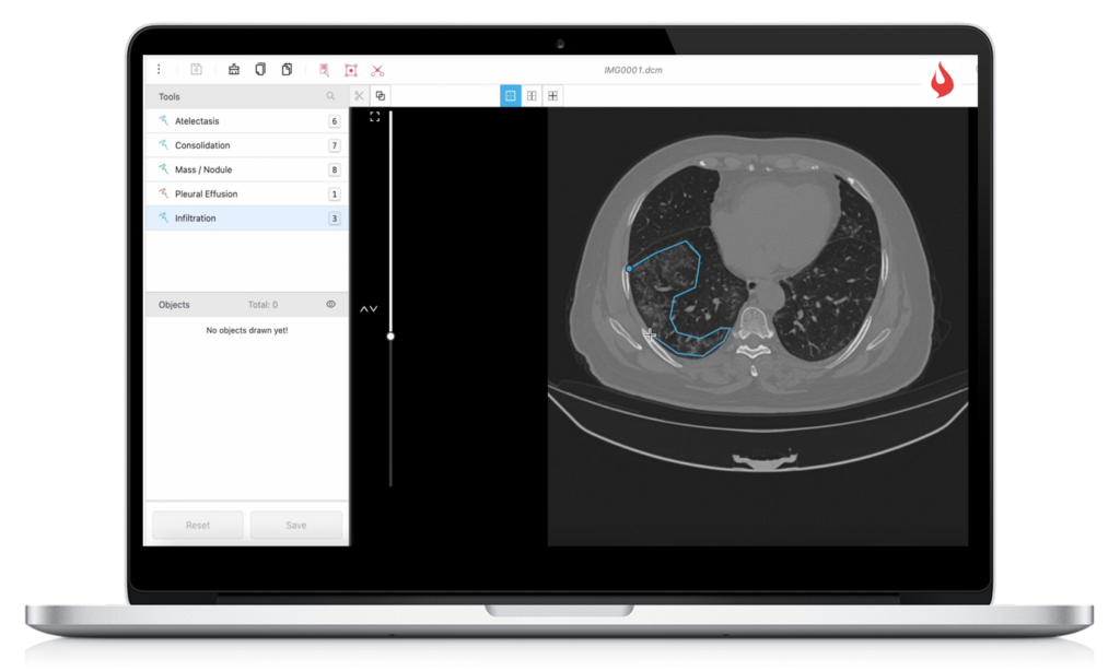 Digital Radiology Image