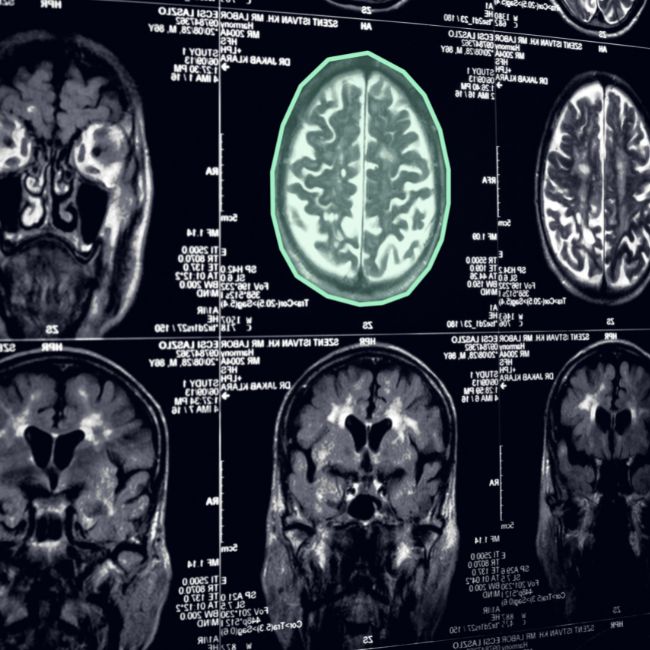 Medical Imaging AI Creating HighQuality Training Dataset for Improved
