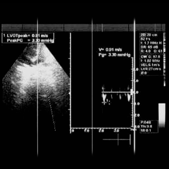Medical Data Annotation and Common Use Cases in Digital Radiology iMerit