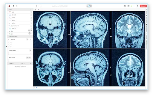 DICOM multi-file viewer in a unified interface