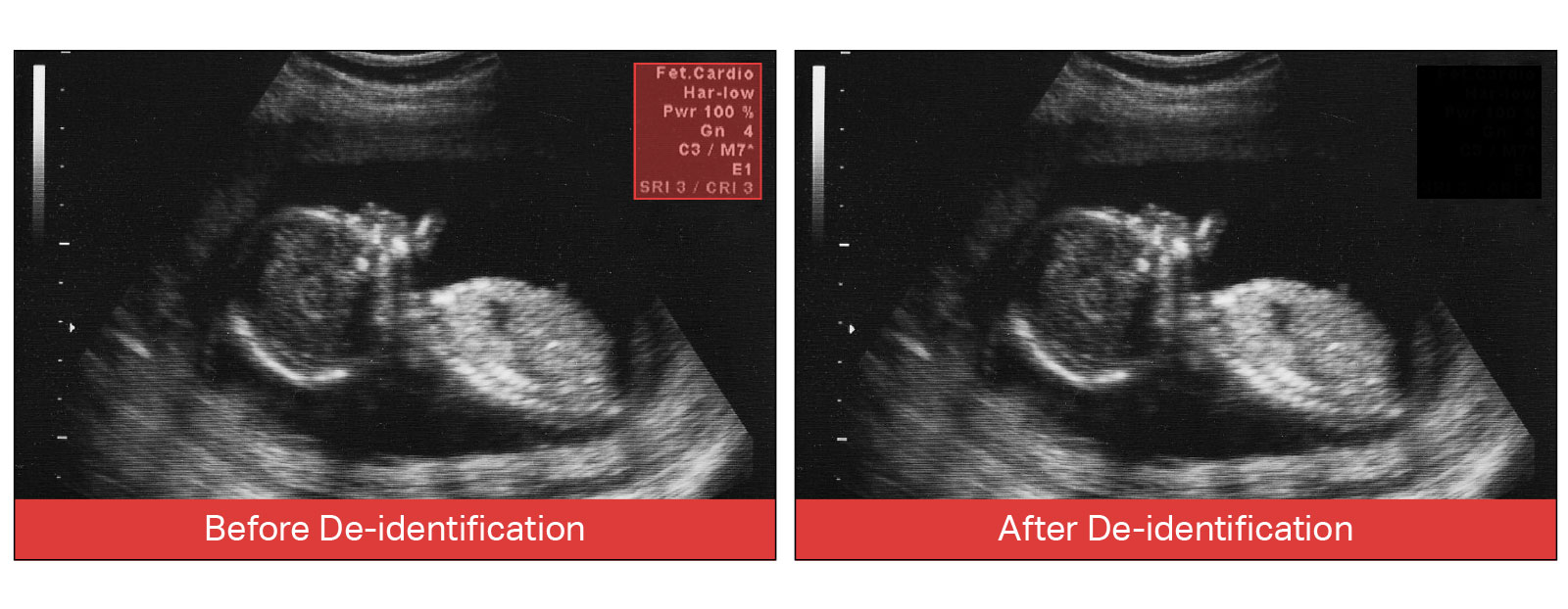 HITL automation for ultrasound video de-identification with AI and human review
