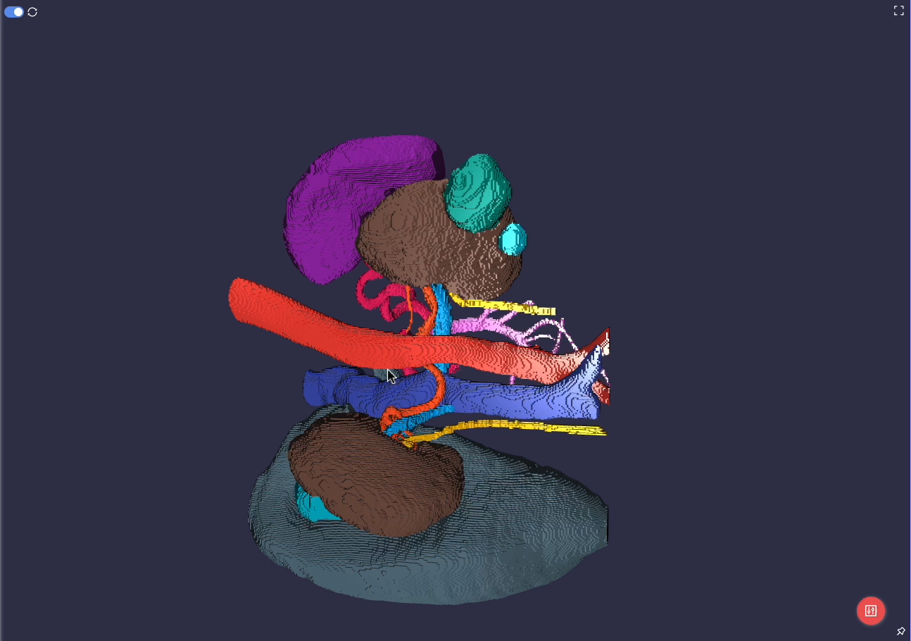 3D-rendered medical view used in complex data annotation workflows