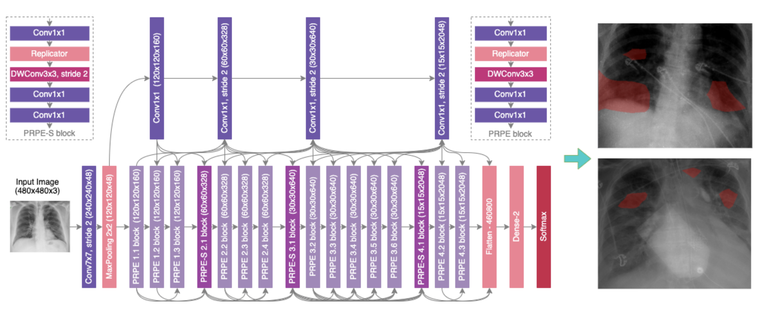 Labeled CT lung scan using iMerit’s Ango Hub for precise radiology annotation