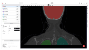 Annotated medical scan showing segmented brain and lung regions