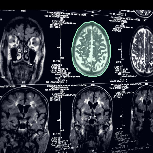 Medical Image Annotation Tools 2025