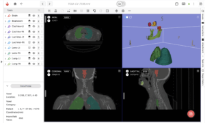 Ango Hub medical labeling editor showing segmented organs in multiple views with annotation tools.