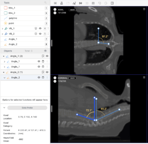 Doctor reviewing digital mammograms, illustrating AI’s role in breast imaging interpretation.
