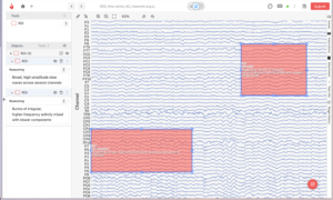 EEG signals across multiple channels with highlighted regions of interest for signal annotation.