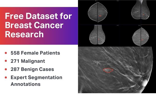dataset for breast cancer research
